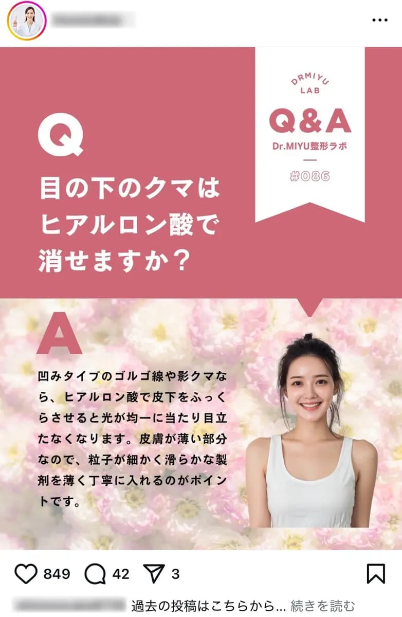 【最高月収75万円の実績】美容医療レポ | 2.9万フォロワー【高単価集客導線】